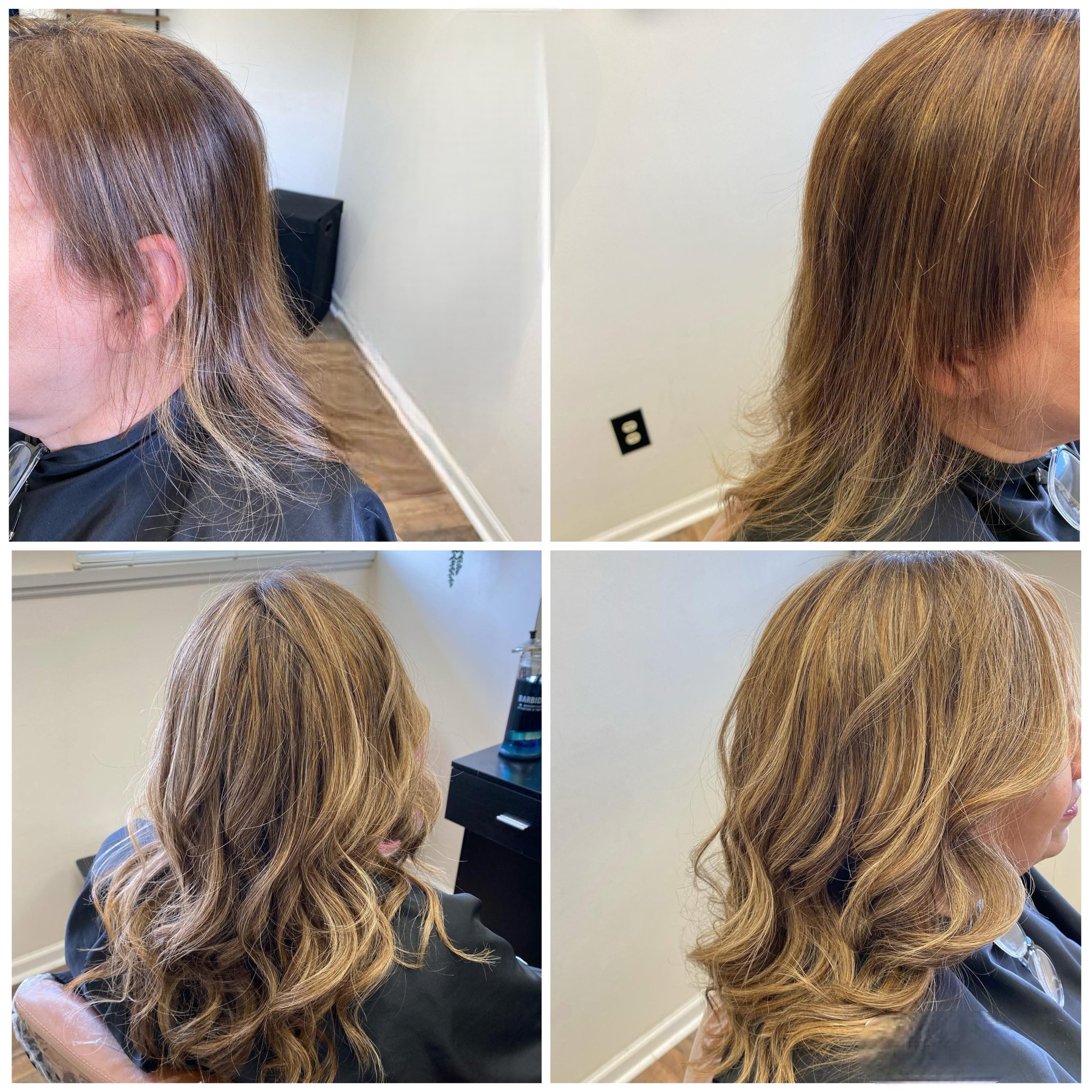 Hair Restoration